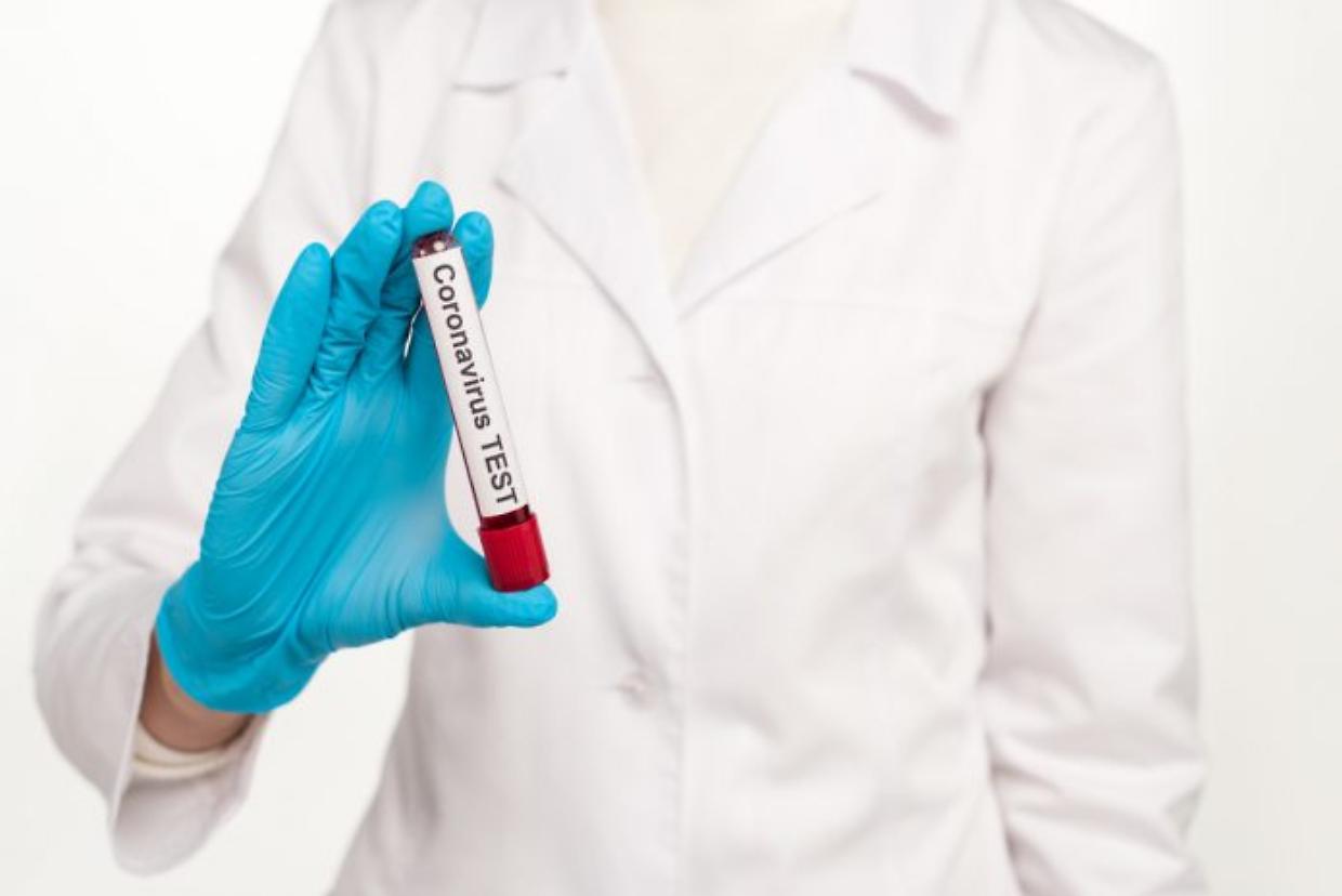 coronavirus test