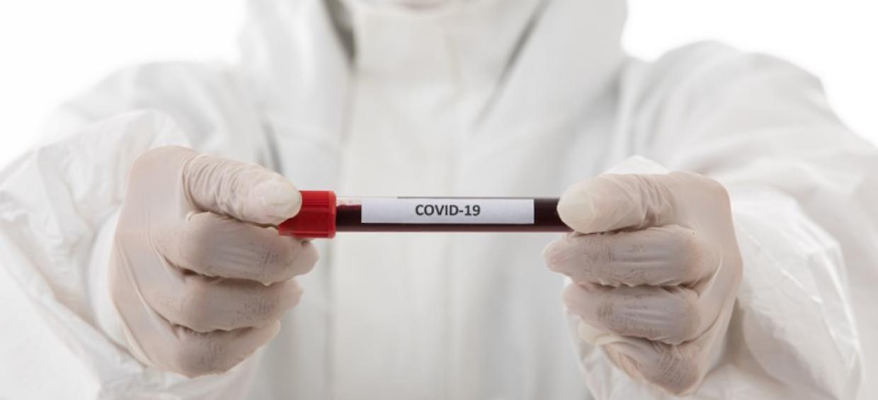Coronavirus