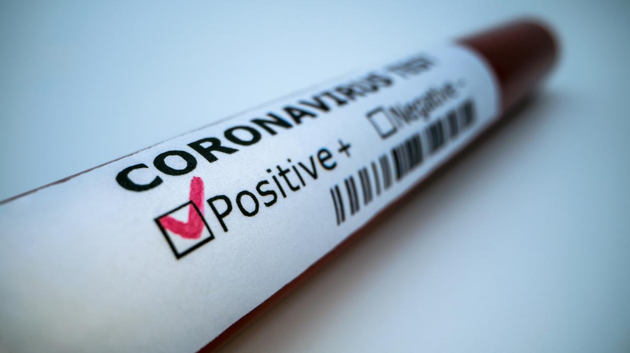 coronavirus test