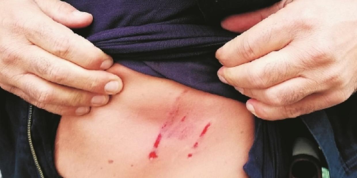 Cani liberi e aggressioni al Parco Ossola di Settimo Torinese