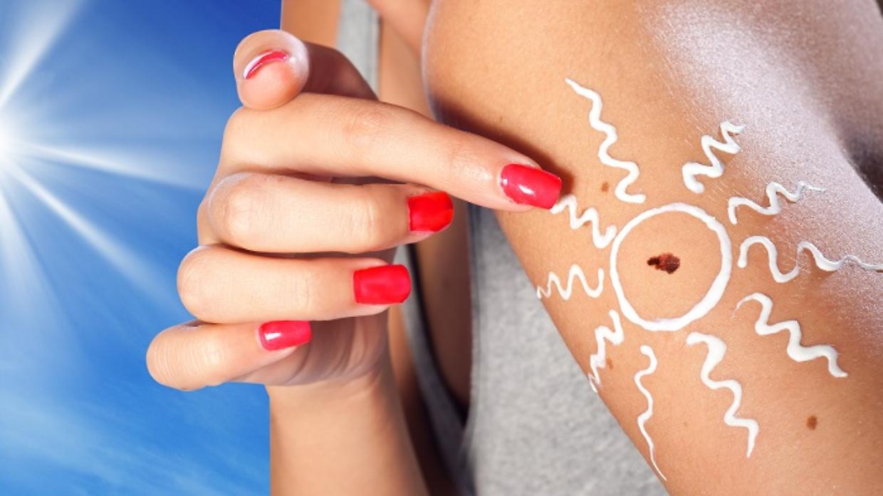 skin cancer melanoma