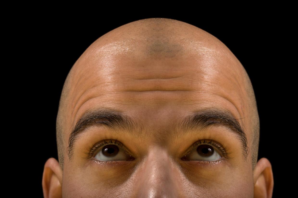 Bald man thinking testa pelata rasato melone