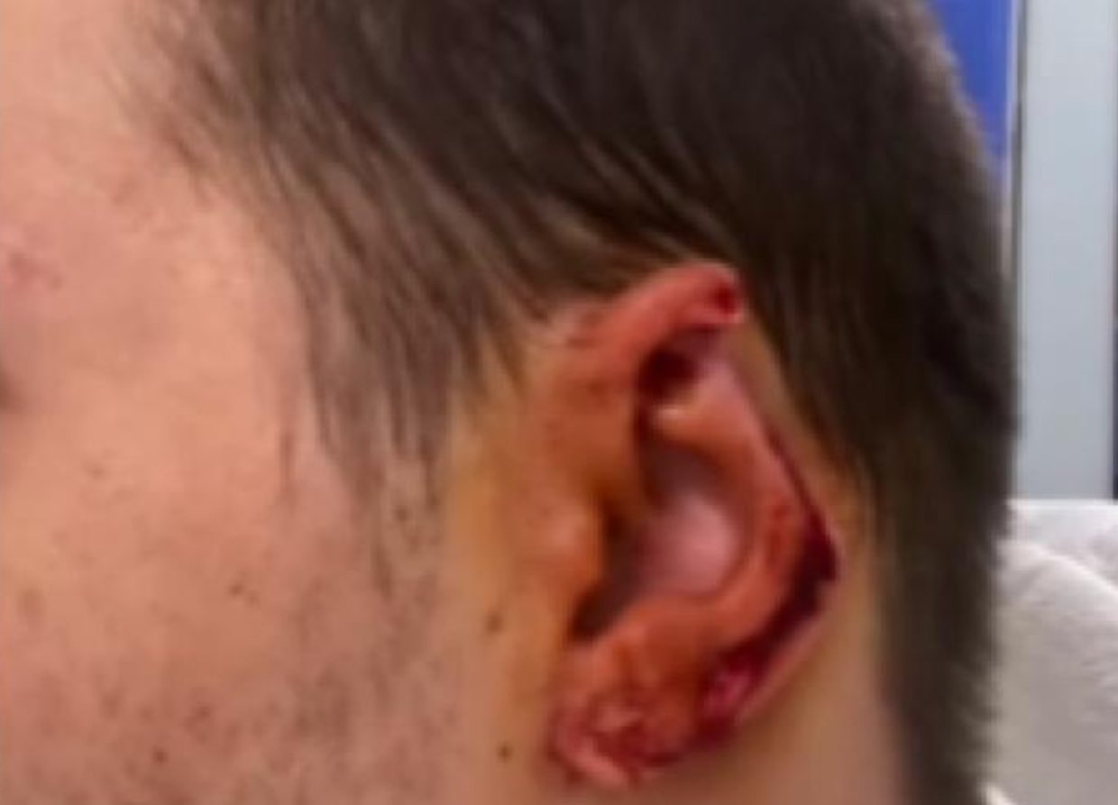 Aggressione omofoba Torino