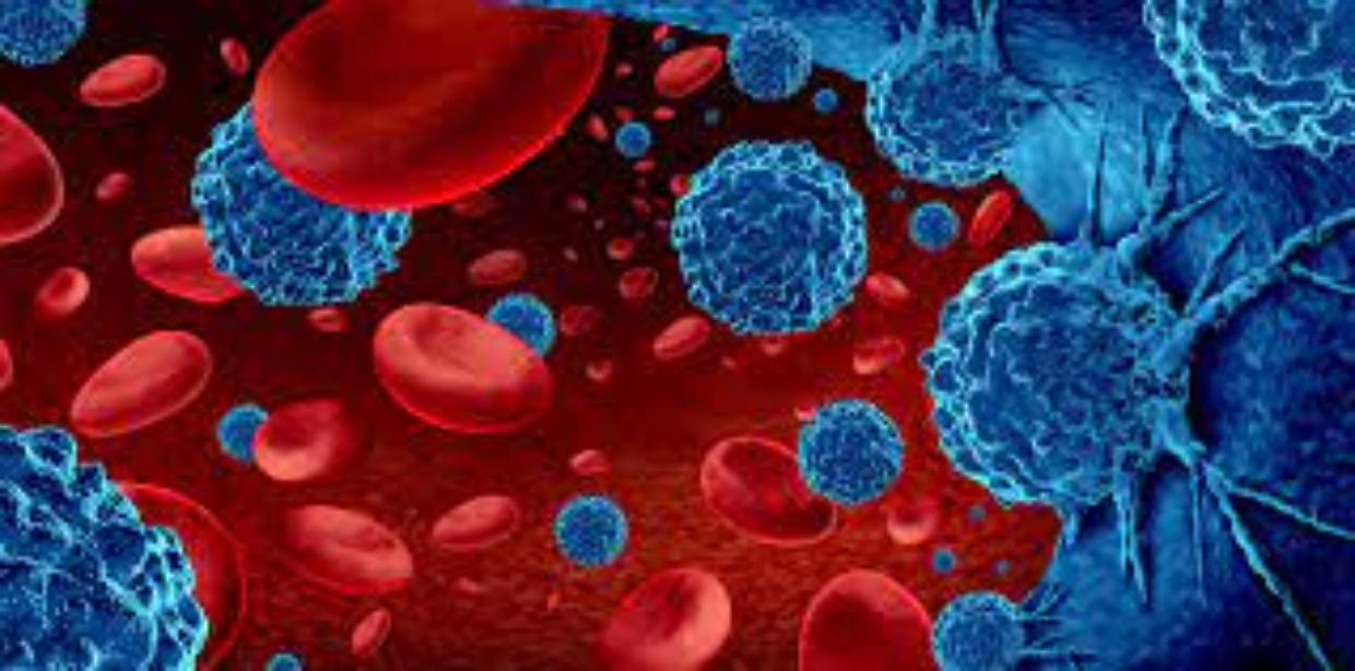Il tumore del sangue che colpisce 1 su 100mila: cos'è la malattia di Baricco