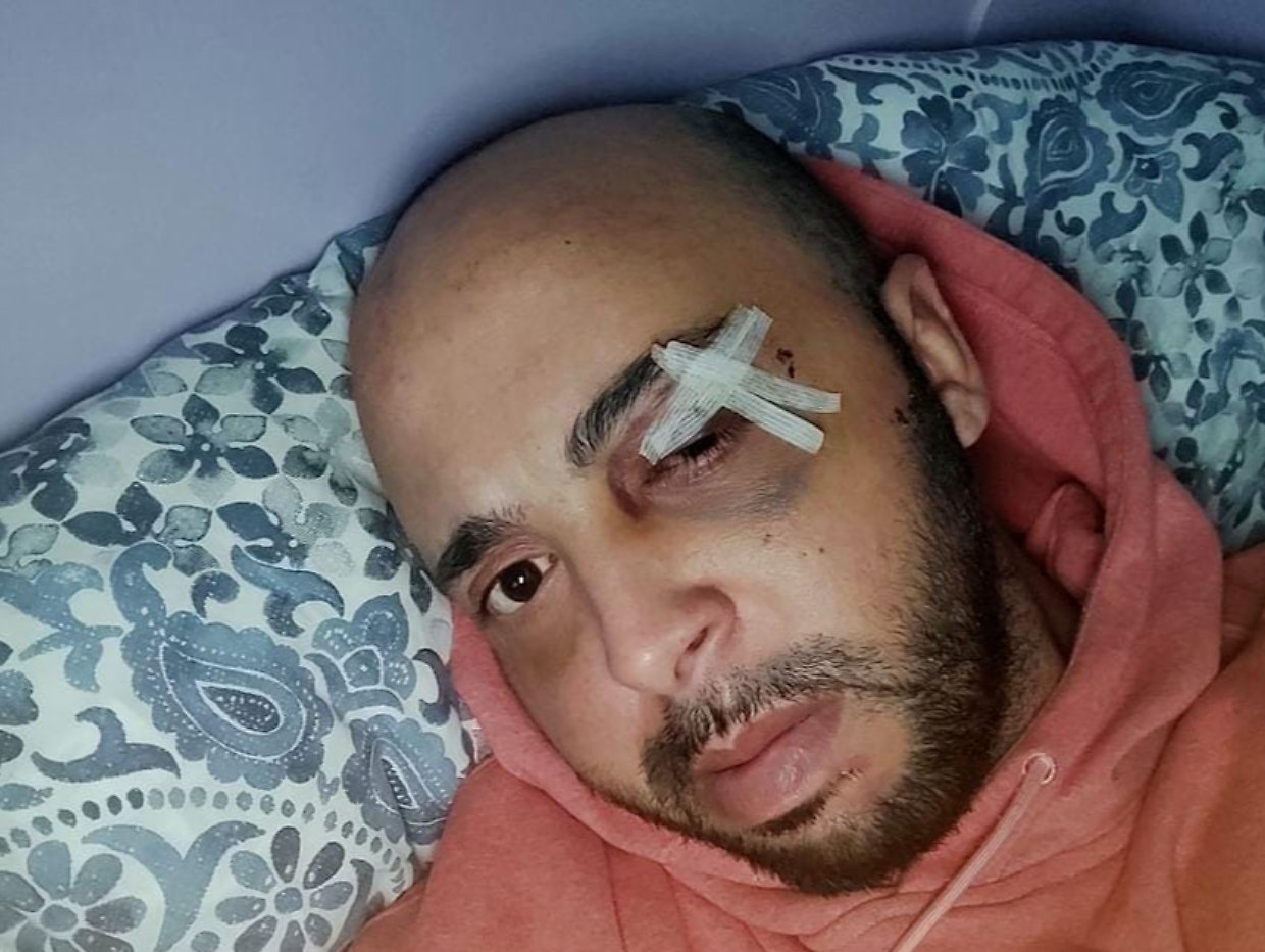 Ecco com'è ridotto Mohammed, pestato in corso Giulio Cesare