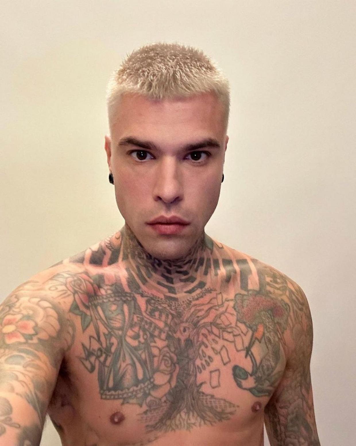 Fedez (Fonte Instagram)