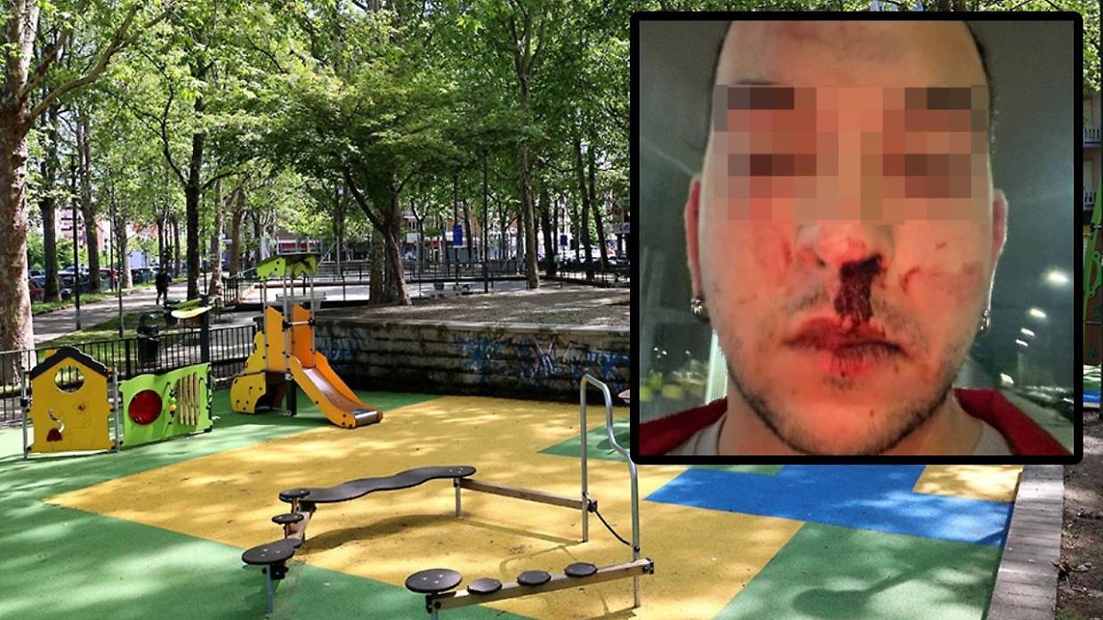 Il 21enne è stato aggredito e picchiato al giardino Peppino Impastato