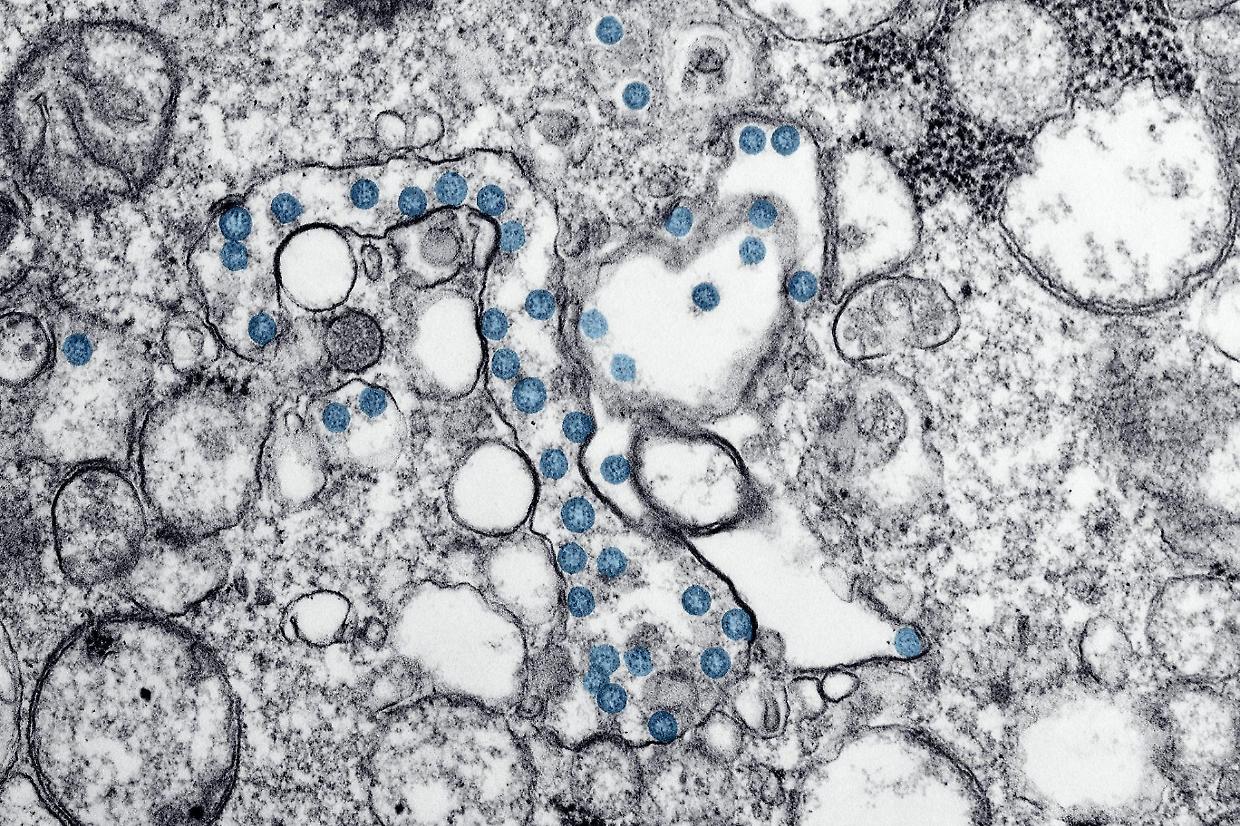 Nano-antenne wireless: la rivoluzione nella diagnosi e cura delle malattie grazie alla bioelettricità