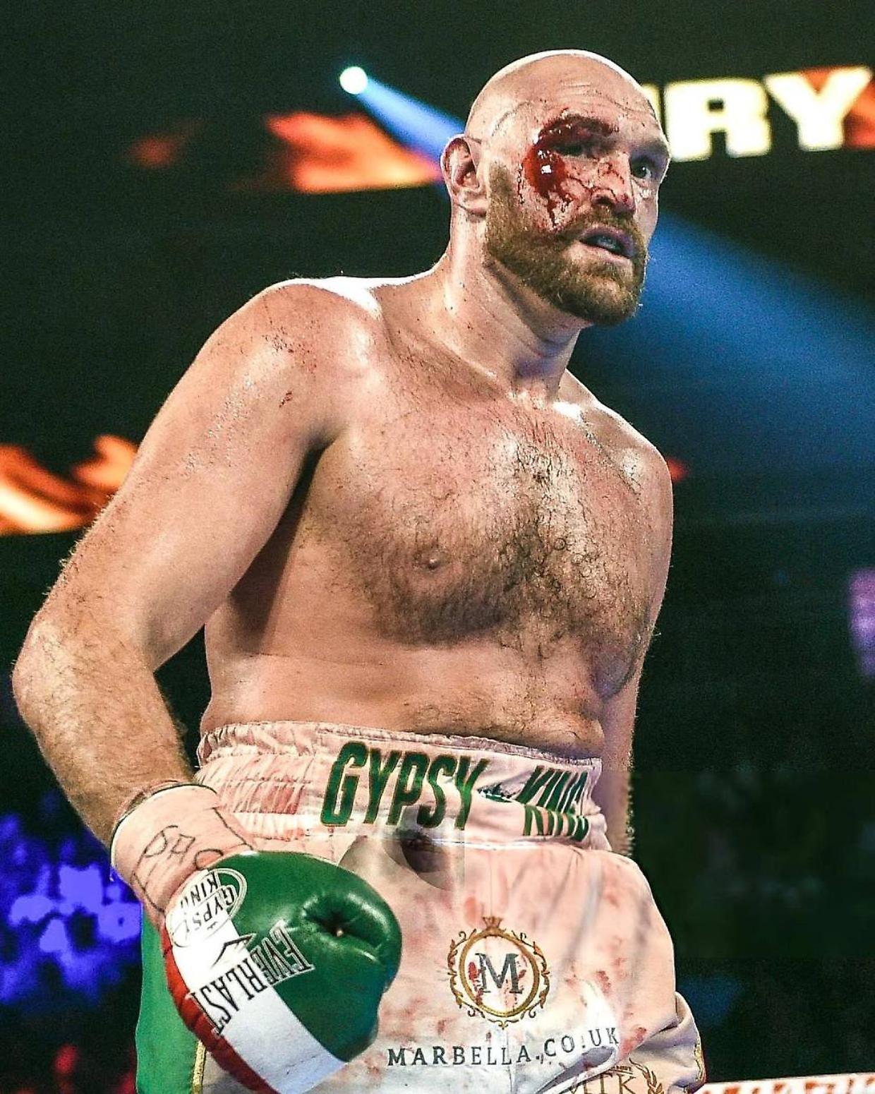 Tyson Fury (Fonte Instagram)