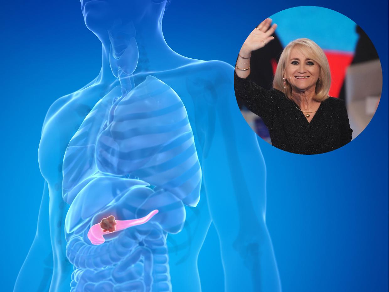Pancreatite acuta: sintomi, cause e cure dell'infiammazione che ha colpito Luciana Littizzetto