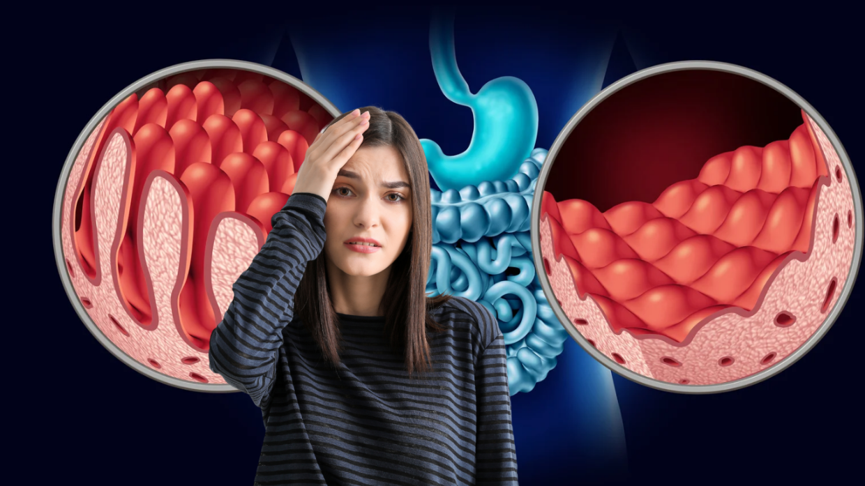 Celiachia: il 70% dei casi riguarda le donne. Ma perché?