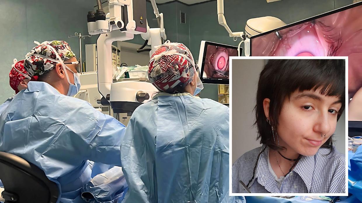 Nati senza iride e operati lo stesso giorno: «Io e mio fratello abbiamo scelto il colore dei nostri occhi»