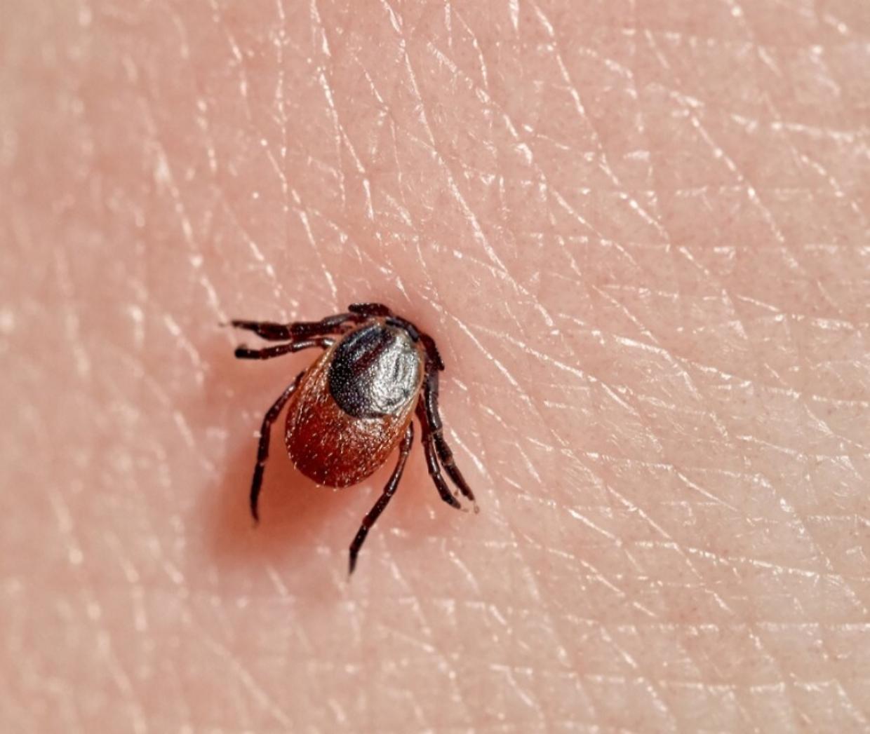 Malattia di Lyme: cos'è, quali sono i sintomi e come si cura
