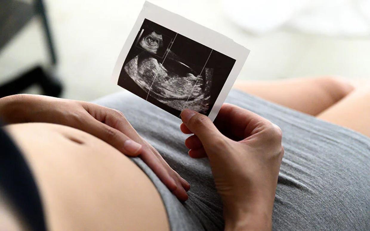 Nascere sani si può: scoperta lista di 300 malattie genetiche curabili prima del parto
