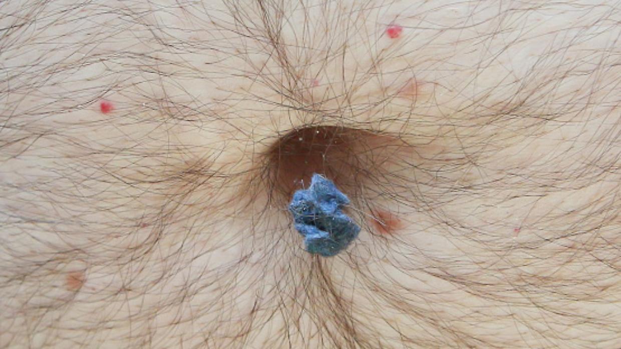Perché nell'ombelico si forma la lanugine? La risposta la dà la scienza