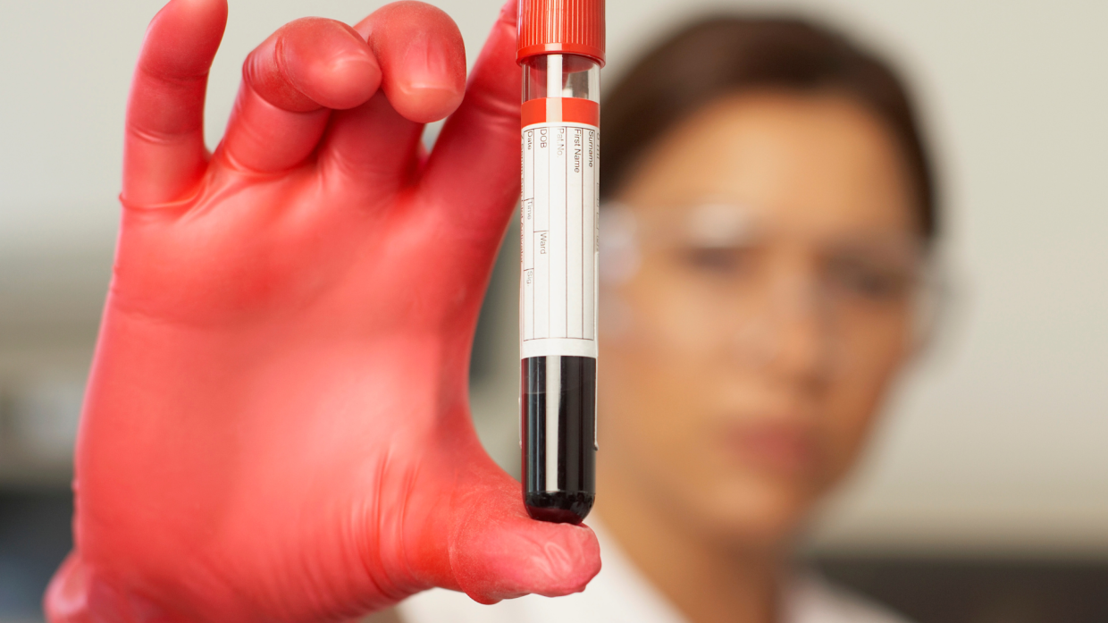 Scoperta choc in Giappone: il sangue artificiale che può rivoluzionare la medicina mondiale