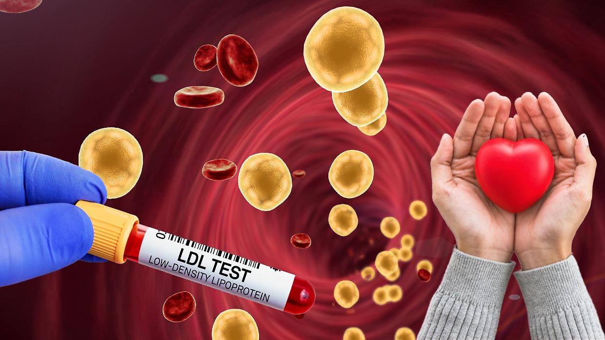 Colesterolo cattivo LDL: al via un farmaco sperimentale che lo riduce del 50%