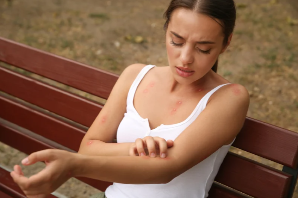 Scabbia in Italia: un incremento dei casi e le difficoltà nel trattamento