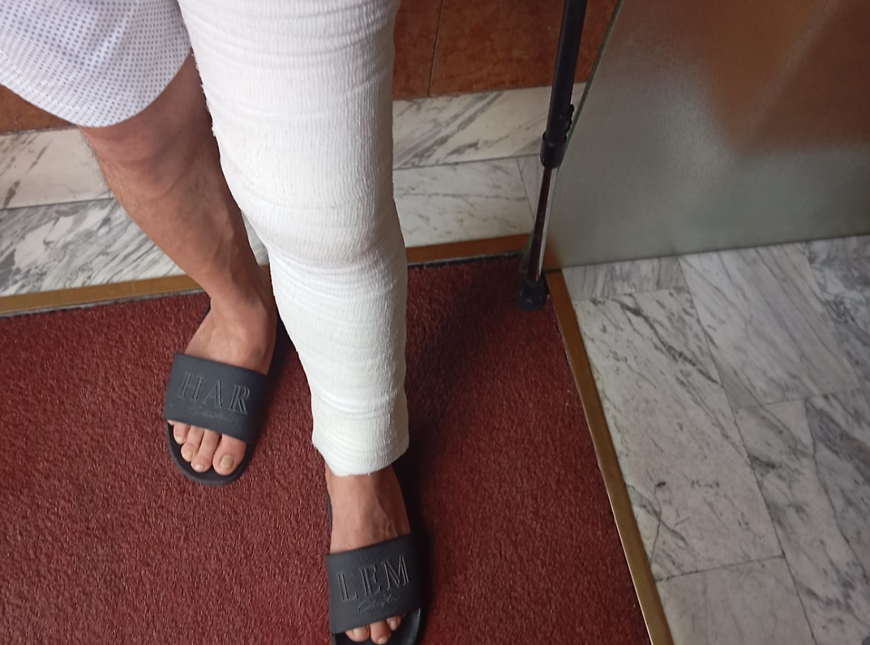 Rapinato a Barriera, un dipendente Stellantis ha riportato la frattura della rotula
