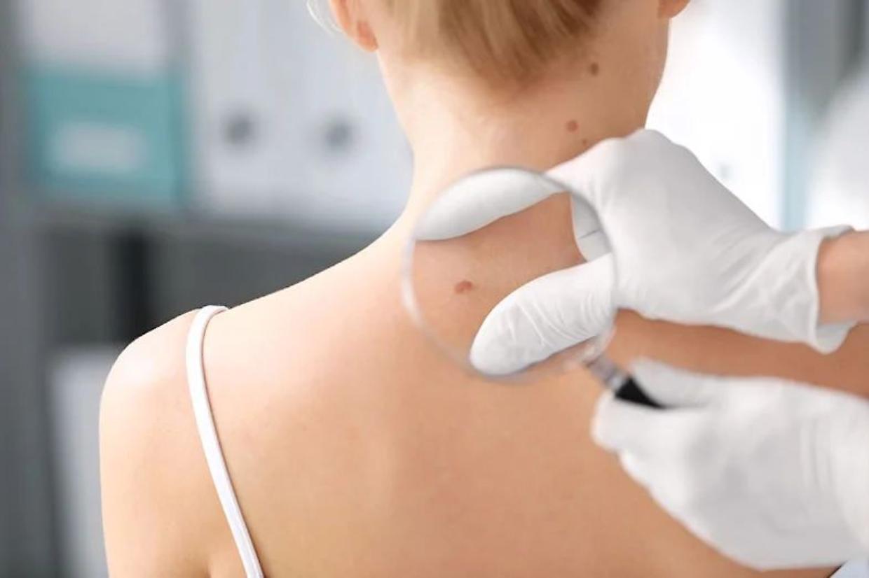 Progettava una piattaforma esclusiva legata alla pedopornografia: arrestato un dermatologo di Chivasso