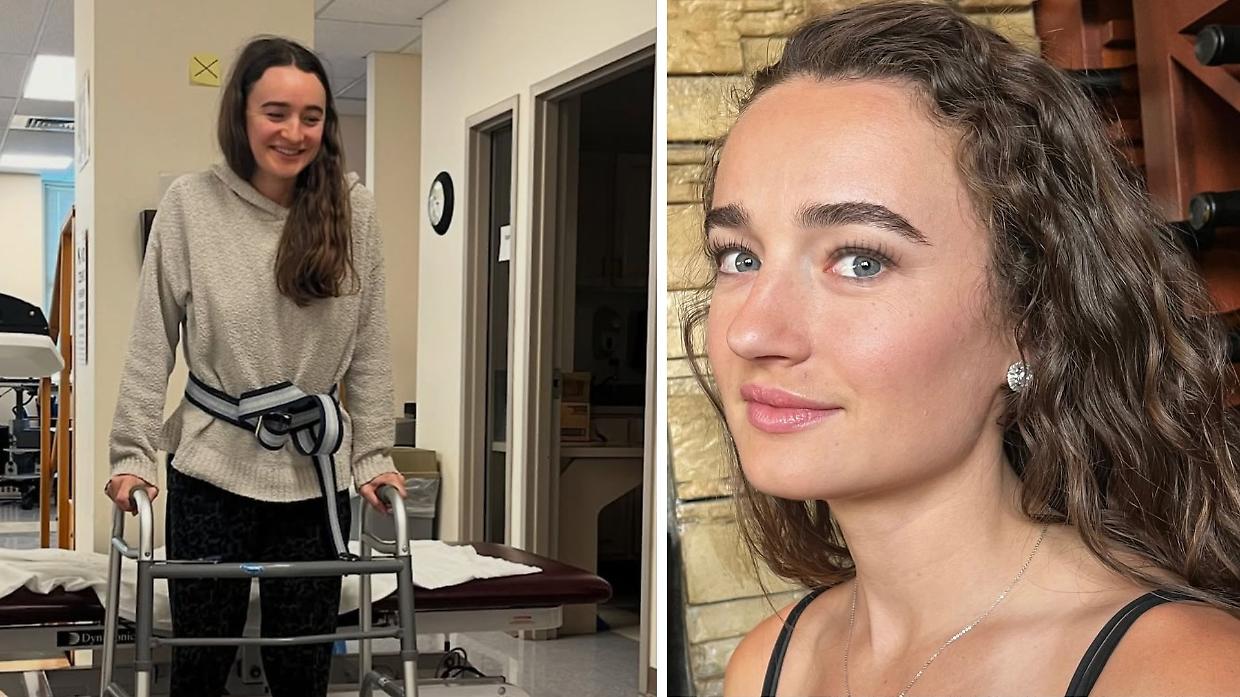 Kelley Mack, morta a 33 anni per un tumore cerebrale raro: cos’è il glioma e come si manifesta