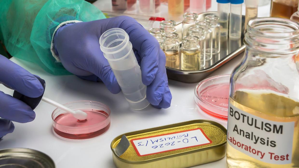 Antidoto contro il botulismo: come funziona e perché ogni minuto è decisivo