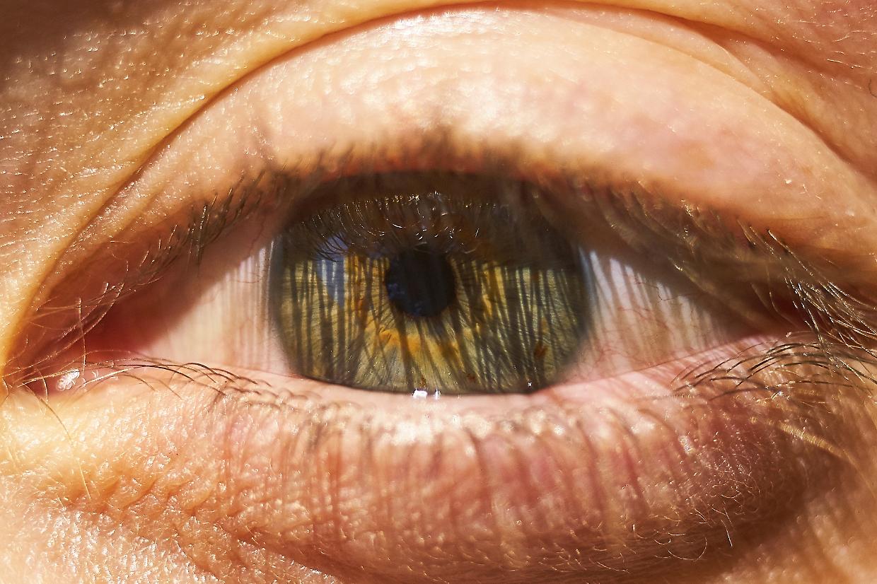 Aveva un verme nell’occhio: il rarissimo caso di gnatostomiasi oculare