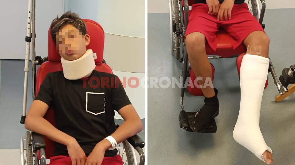 Collegno, la Figc ritira l'invito al portiere picchiato del Volpiano dopo la squalifica di un anno
