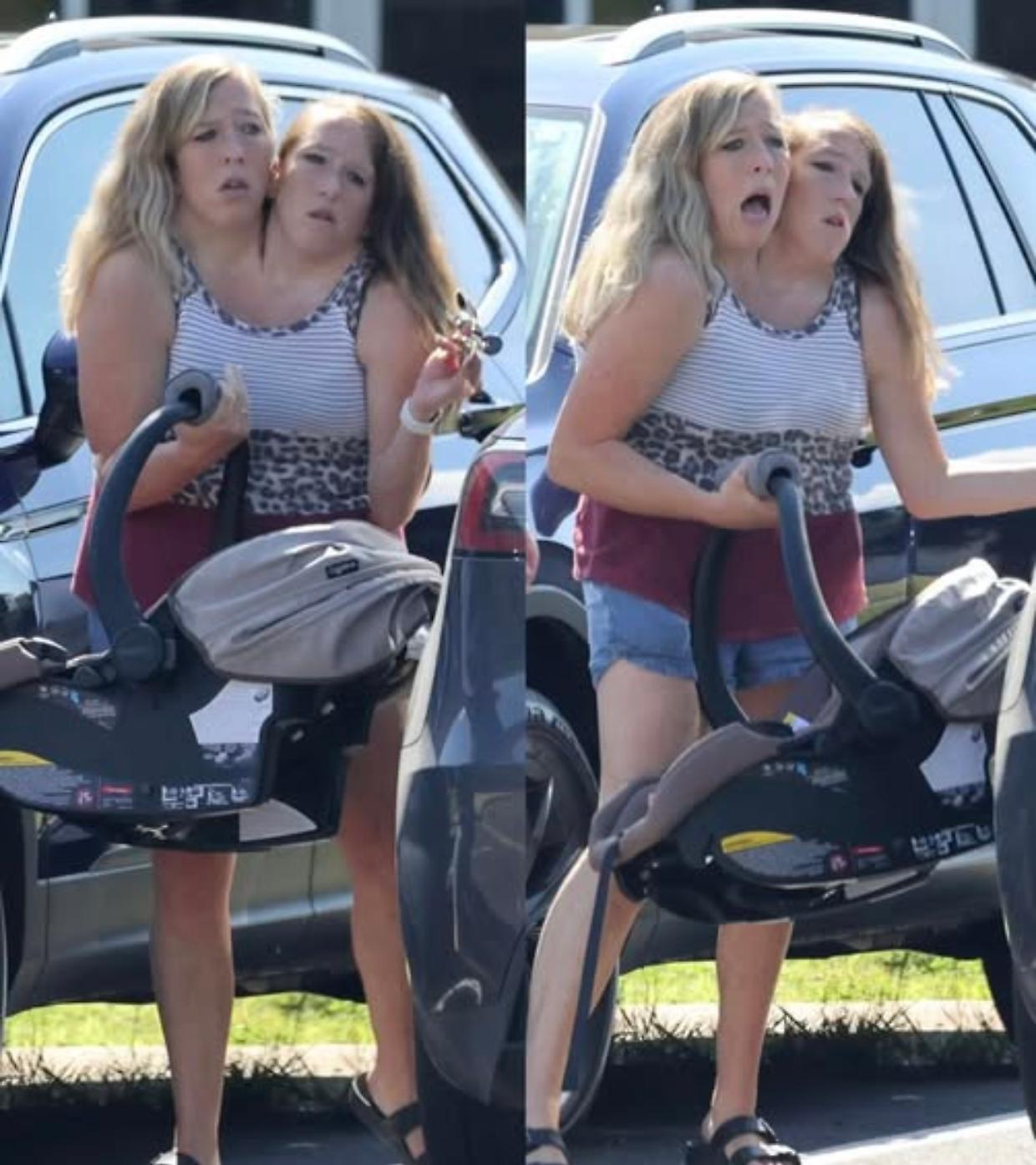 Le due gemelle siamesi Abby e Brittany partoriscono il loro primo figlio