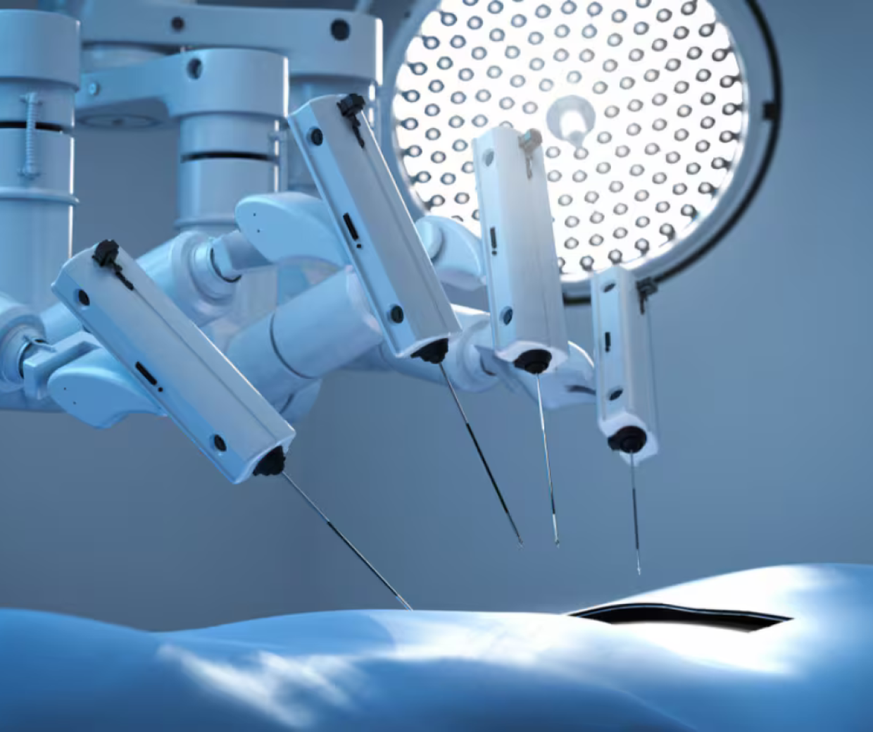 Chirurgia robotica in Piemonte: Agenas impone lo stop agli acquisti senza autorizzazione