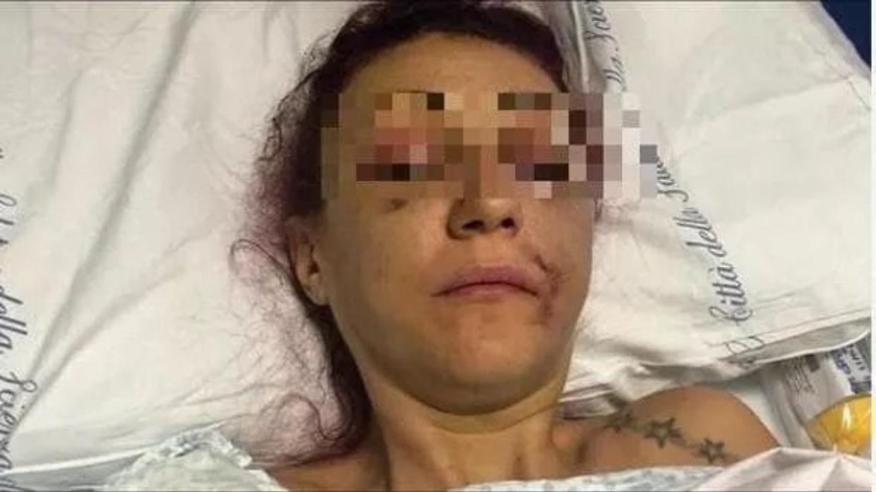 Lucia Regna, il volto spaccato a pugni «Nessuna condanna per maltrattamenti»