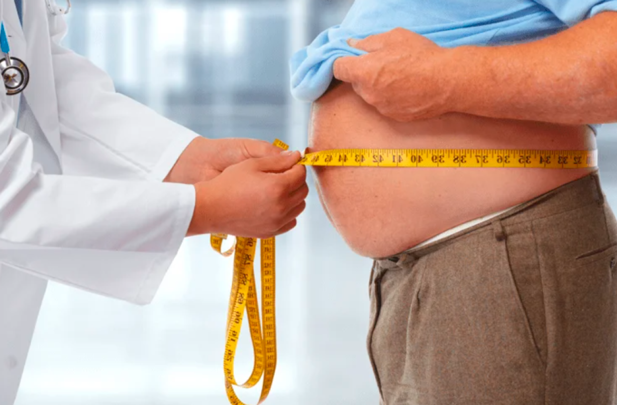 Obesità, approvata la legge: non più “colpa del cibo” ma malattia da curare