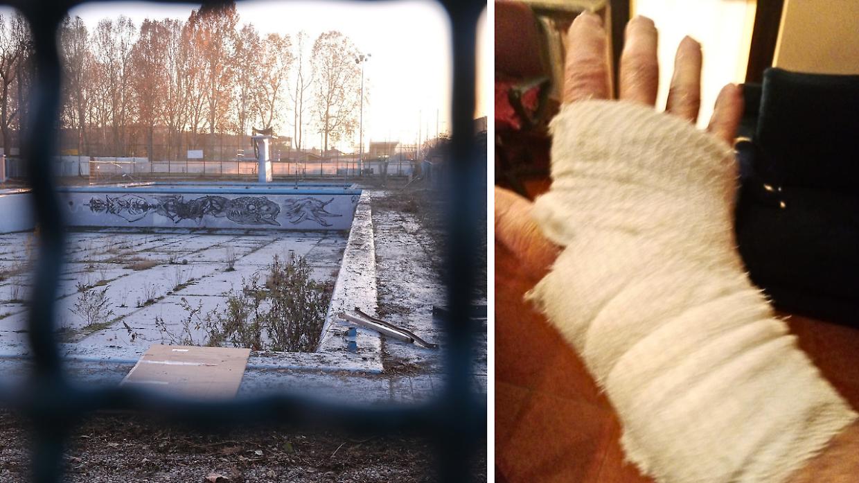 I pitbull degli spacciatori azzannano un 82enne e il suo cane
