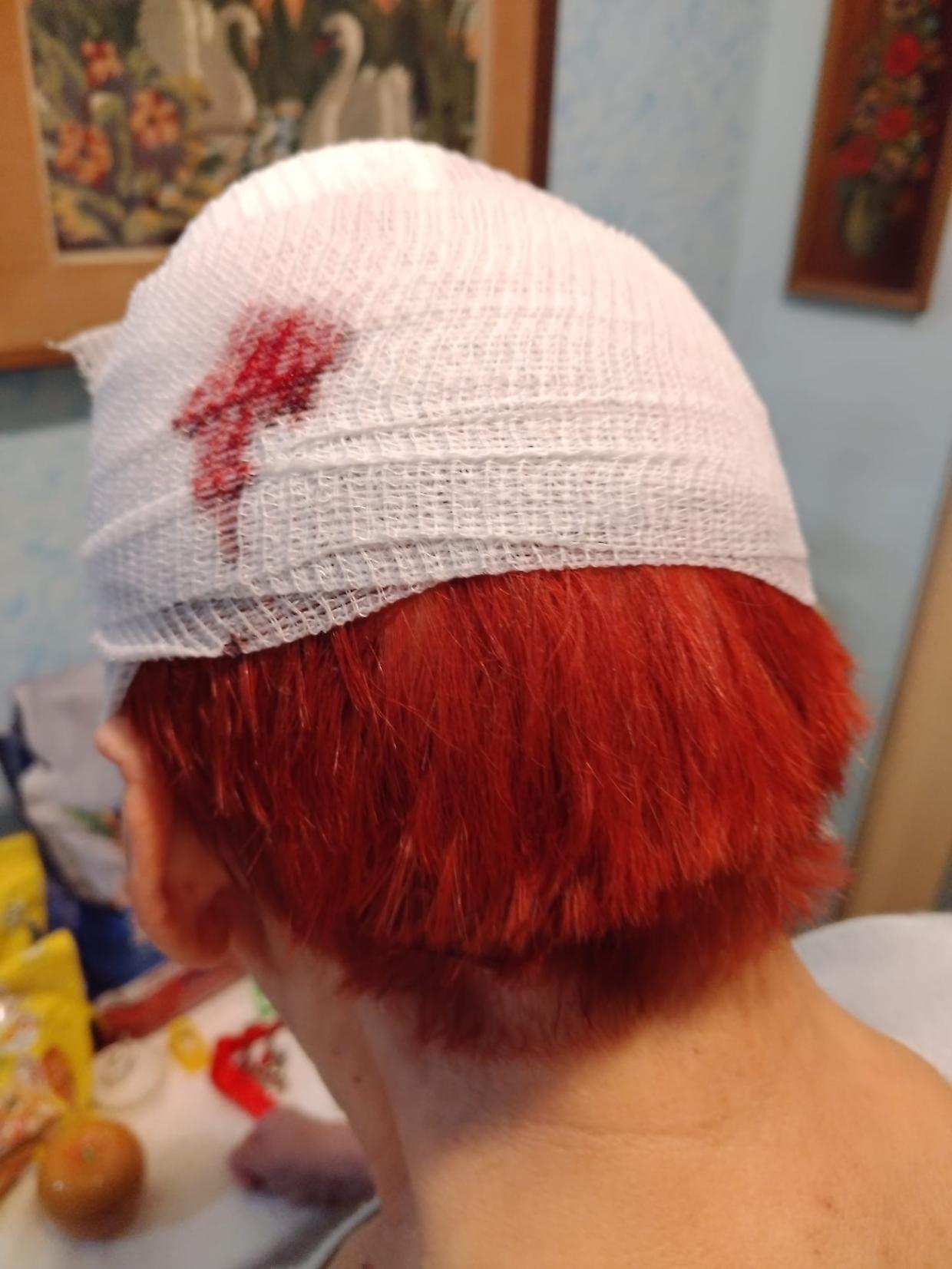 81enne cade mentre lucida una lapide, la figlia: "I vigilanti hanno sminuito ma poteva morire"