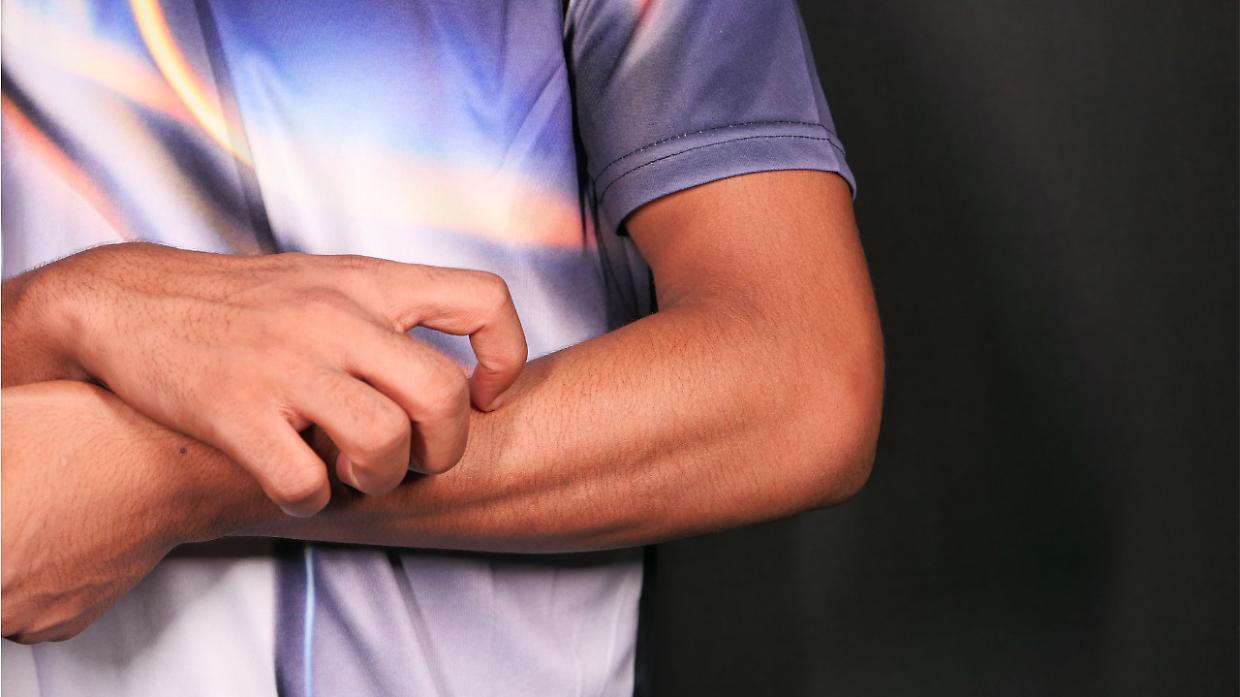 Allarme scabbia in Piemonte: casi triplicati in 4 anni. In dodici mesi 267 focolai e 2.239 casi