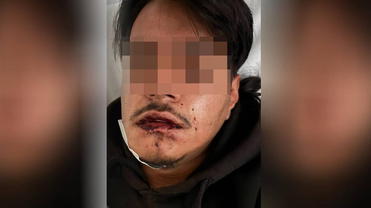 Ivan, aggredito in centro da una baby-gang