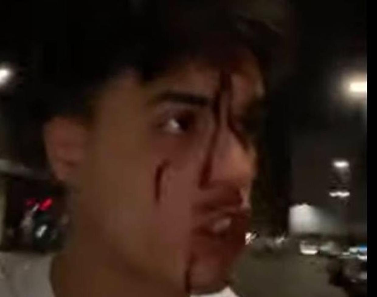 Don Alì picchiato a Milano: c’è chi dice sia solo una trovata spot