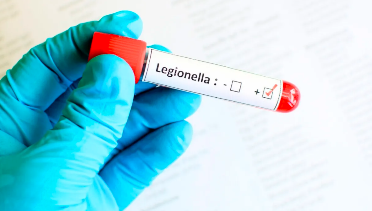 Legionella in aumento anche in Piemonte: cosa sapere e come proteggersi