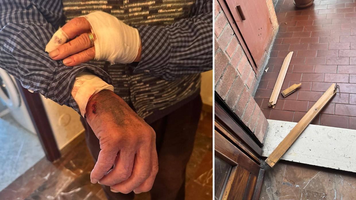 Ladro entra in casa e pesta un 86enne. Terrore a Barriera: «E' uno dei tossici del parco Sempione»