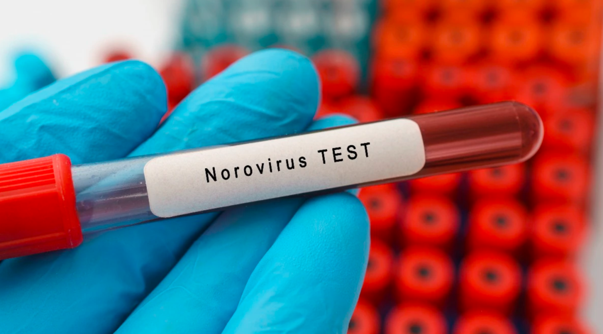 Norovirus, allerta sanitaria a Milano Cortina 2026