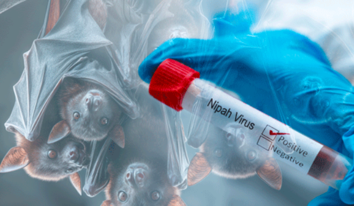 Virus Nipah: al via i primi test sull&rsquo;uomo del vaccino contro l&rsquo;infezione ad alta mortalit&agrave;