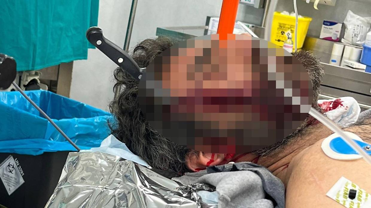 Il ferito al San Giovanni Bosco