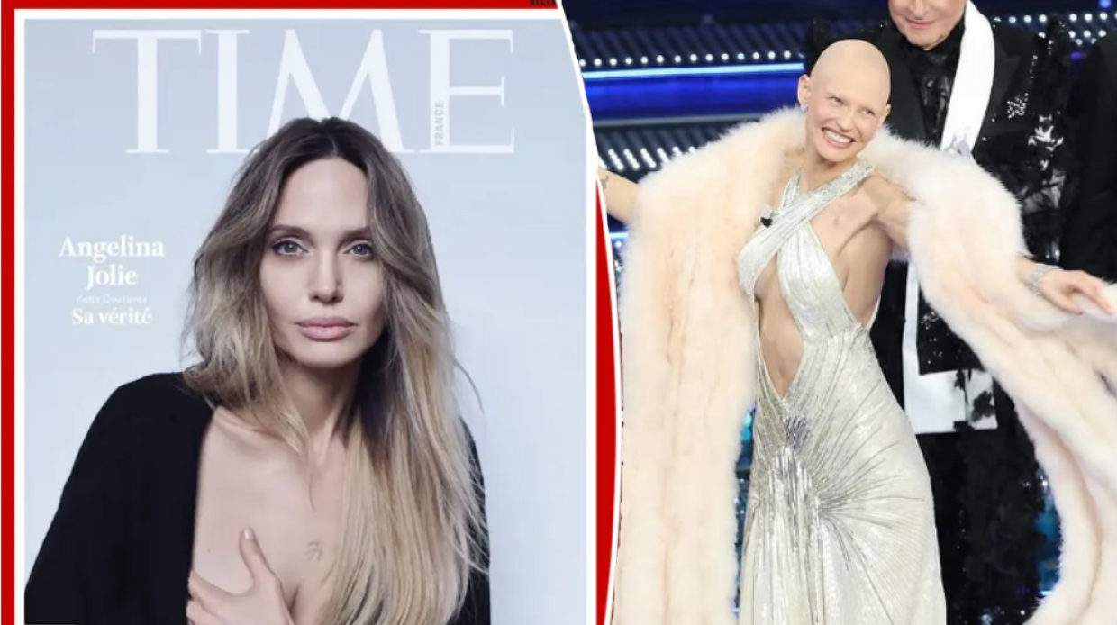 La &ldquo;sindrome di Angiolina Jolie&rdquo;, una malformazione pi&ugrave; comune di quel che si pensa