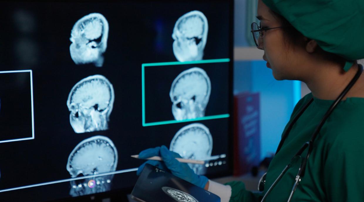 Malattie rare, da Torino una scoperta che apre nuove strade per le terapie