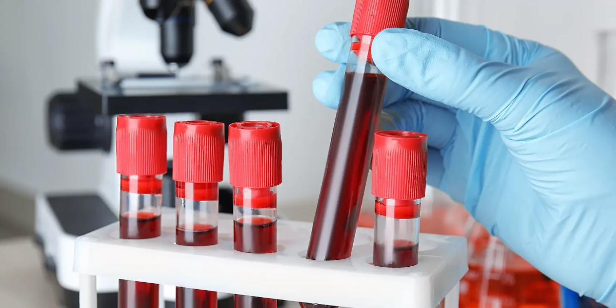 Piemonte, diabete e celiachia, al via i nuovi test gratuiti per bambini 