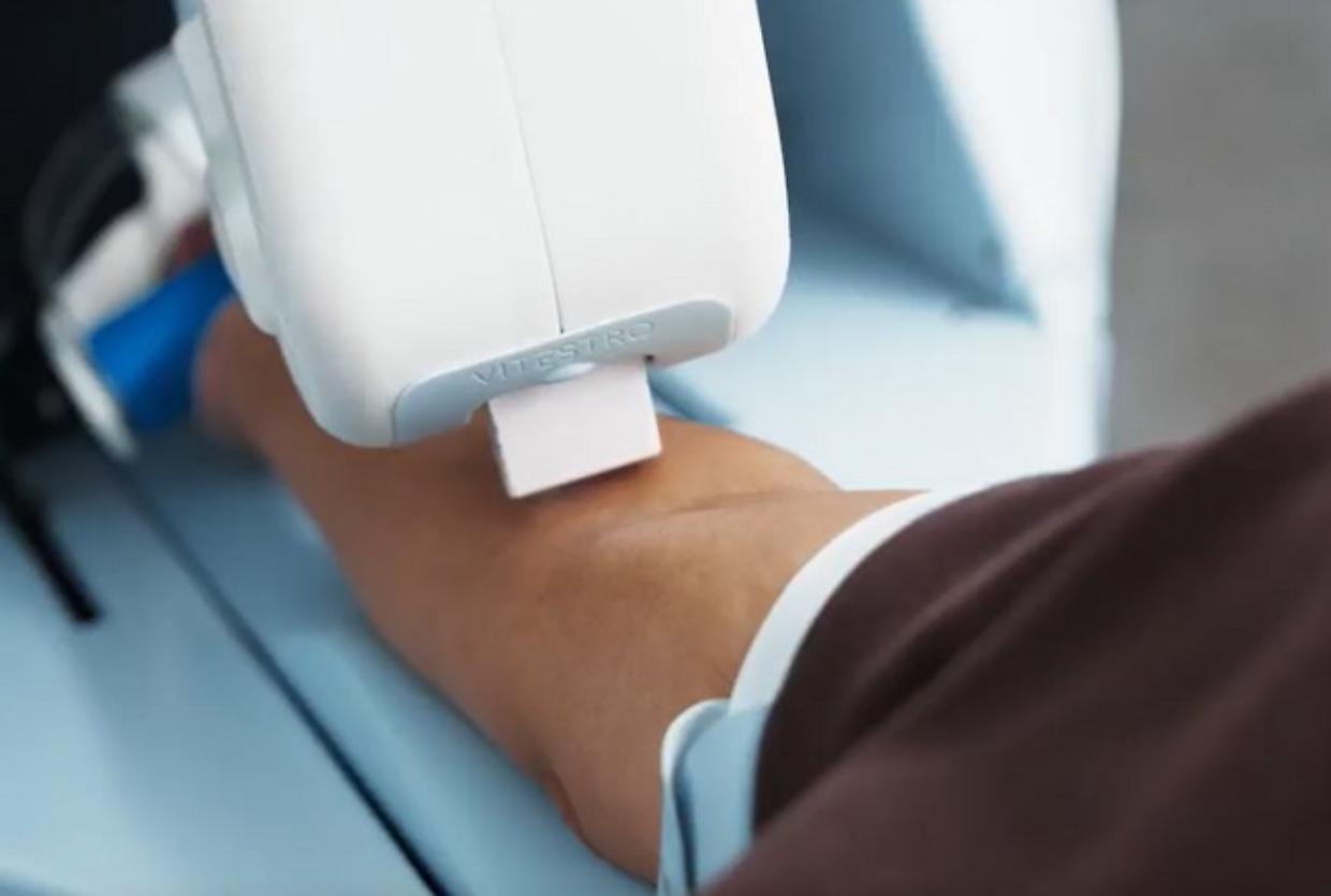 Arriva Aletta: il primo robot che preleva il sangue in autonomia