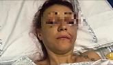 Lucia Regna, il volto spaccato a pugni «Nessuna condanna per maltrattamenti»