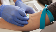 Celiachia, verso una diagnosi senza biopsia anche negli adulti: cosa cambia con le nuove linee guida