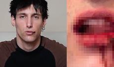 Il creator e modello Leo Mel aggredito sotto casa: un anno di minacce e violenze, &ldquo;Ma lui &egrave; ancora libero&rdquo;