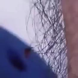 Peli corporei: una barriera naturale contro le zanzare?